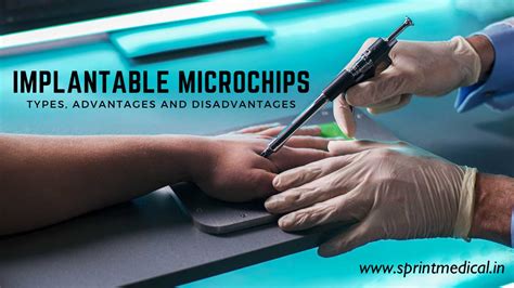 impact of rfid chips in children|Human Microchipping: The Benefits and Disadvantages .